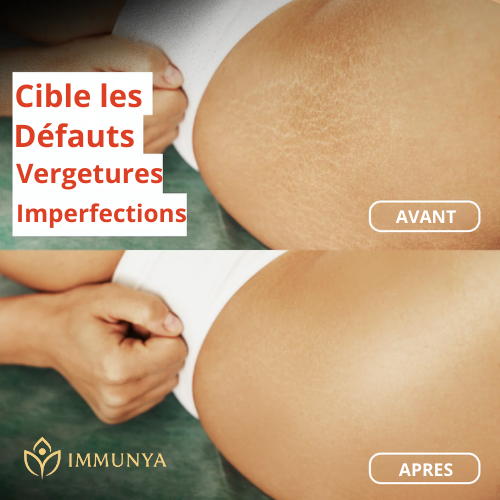 Immunya - Huile corporelle Magique